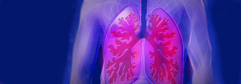 Erleidet ein COPD-Patient unter dualer Bronchodilatation weiter Exazerbationen, braucht er womöglich eine Dreifachkombination.