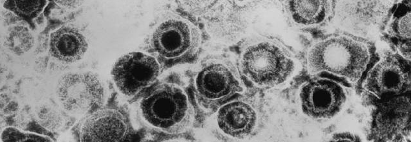 Mithilfe eines modifizierten Herpes-simplex-Virus namens T-VEC kann die Knötchen des Melanoms beseitigen.