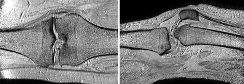 Bei der Gonarthrose gibt es viele verschiedene medikamentöse Möglichkeiten, um das Knie wieder in Schwung zu bringen. 