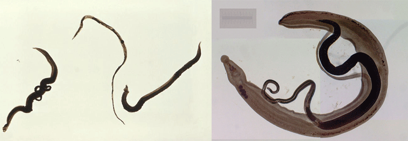 In Brasilien und Afrika tritt verhäuft der sogenannte Schistosomiasis mansoni auf (links), in  Asien dagegen eher der Schistosomiasis japonica (rechts).
