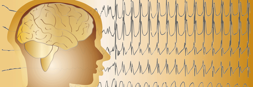 Es lohnt sich, bei Patienten mit refraktärer Epilepsie über eine OP nachzudenken.