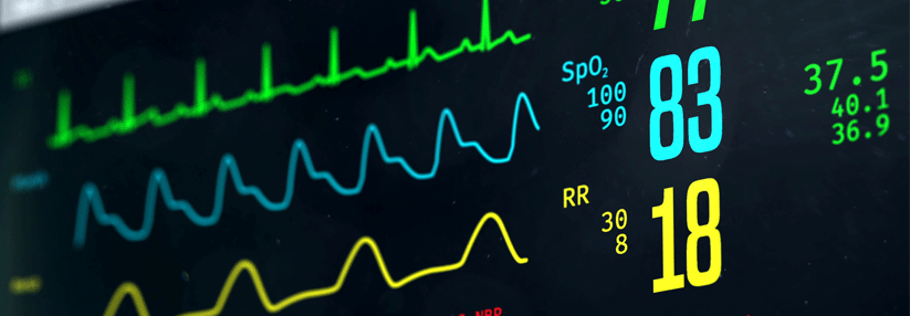Herzrasen und Angst: Panikattacke, Rhythmusstörung oder beides? Auch bei unauffälligem EKG zwischen den Episoden sollte man die Symptome nicht vorschnell als Panikattacke abstempeln.