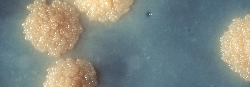Tuberkulosebefund in drei Tagen: Immunzellnachweis beschleunigt die Diagnostik Anhand des PCR-Schnelltests und dem Immunzellnachweis können die Tuberkulose-Bakterien in kürzester Zeit festgestellt werden.