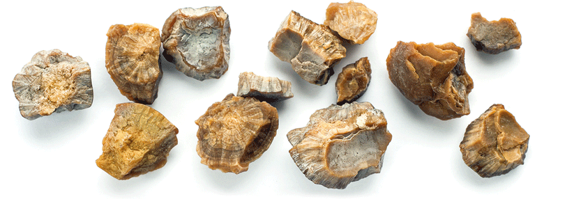 Bei Steinen unter 9 mm brachte Tamsulosin in der Studie nichts.