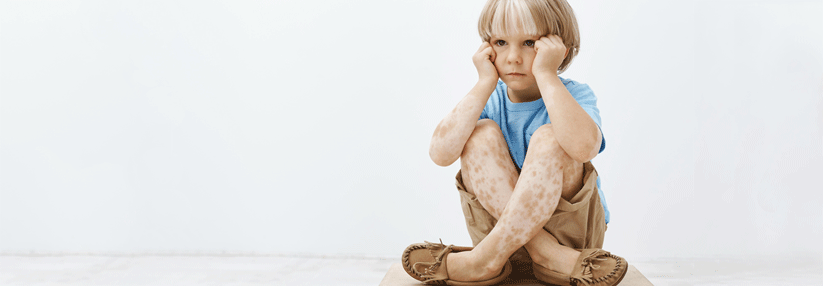 Viele Kinder und Jungendliche leiden auch psychisch unter den Hautveränderungen.