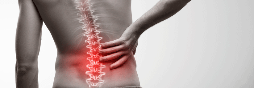 Lumbale Radikulopathie erfordert Bewegung statt Bettruhe Besteht das Risiko einer Chronifizierung, hilft die Kombi aus Physio- und Psychotherapie.