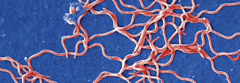 Neuroborreliose: „Die Prognose ist exzellent“ Patienten mit Neuroborreliose erkranken häufiger an Hautkrebs – möglicherweise deshalb, weil sie mehr draußen unterwegs sind.