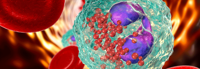 Neben Exazerbationshistorie und Risikoprofil lassen sich Eosinophilenzahlen im Blut als Leitschnur für die COPD-Therapie nutzen.