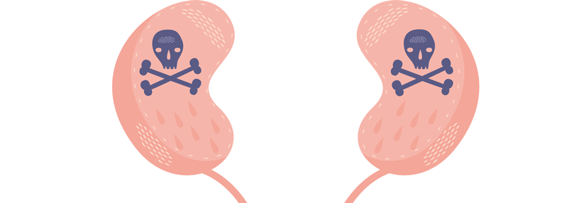 Nierenschäden können auch nach Immuncheckpoint-Inhibition auftreten.