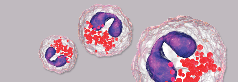 Der zerstörerische Inhalt ermöglicht es 
Eosinophilen, große Parasiten abzutöten. Manchmal geht der Schuss aber nach hinten los.