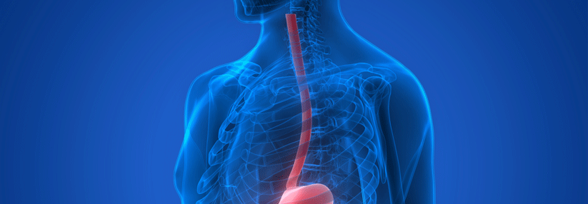 Künftig sollte direkt bei Erstdiagnose von Ösophaguskarzinomen der PD-L1-Status angefordert werden.