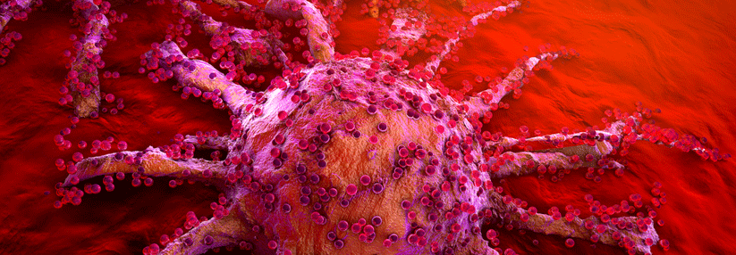 Nicht, dass die Krebserkrankung schon schlimm genug wäre. Häufig erleiden die Tumor-Patienten nach erfolgreicher Behandlung weitere Krankheiten.