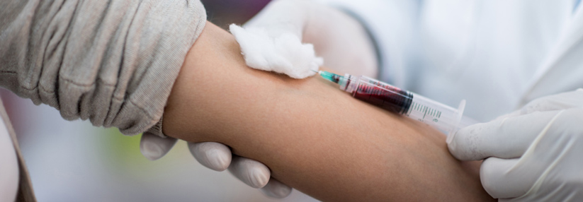 Lipidbestimmung: Patienten müssen keineswegs nüchtern in die Praxis kommen Die Blutentnahme zur Lipidbestimmung ist auch nach dem Frühstück aussagekräftig.