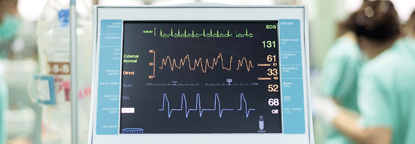 Am Monitor der intraaortalen Ballonpumpe wird die Zirkulation überwacht. Das Device soll einem kardiogenen Schock vorbeugen.