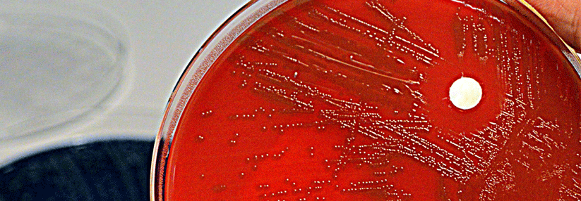 An durch S. pneumoniae verursachten Lungenentzündungen sterben in Deutschland jedes Jahr über 10 000 Menschen.