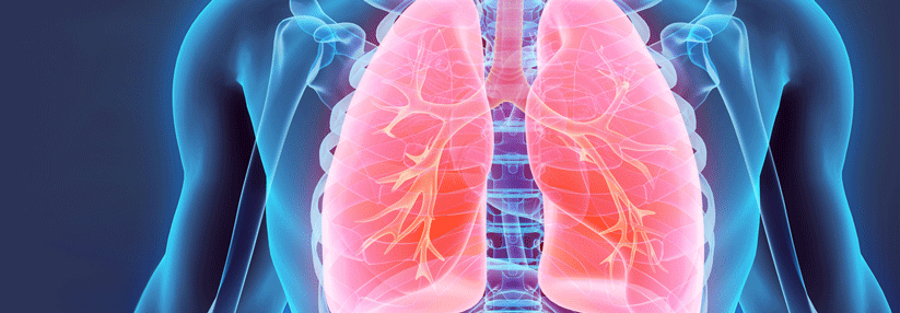 Lungenkrebspatienten haben die schlechteste Prognose.