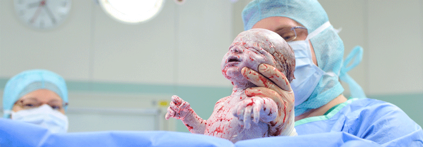 Das Kind kam per Kaiserschnitt zur Welt (Agenturfoto).