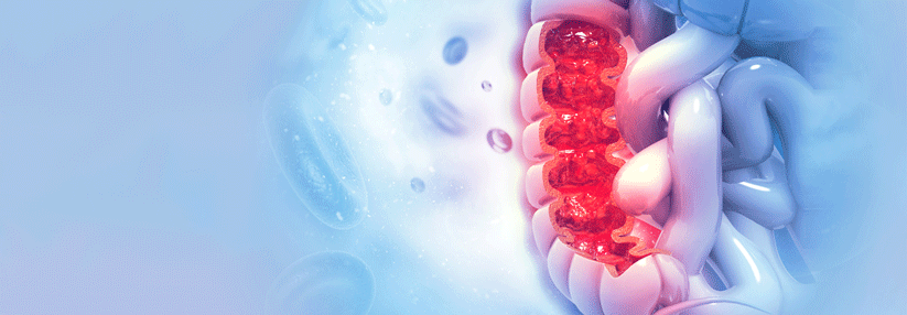 50 % der Nachfahren tragen dieselbe Mutation.