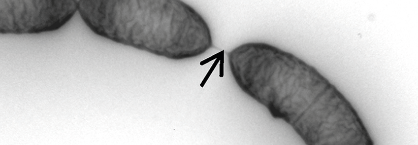Das meist in Ketten vorkommende Bakterium Lactobacillus rhamnosus GG ist kein fester Bestandteil der Darmflora – es ist nur nachweisbar, solange man es täglich zu sich nimmt.