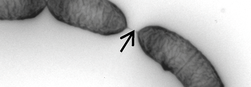 Laktobazillen lassen Kinder mit Gastroenteritis nicht schneller gesund werden Das meist in Ketten vorkommende Bakterium Lactobacillus rhamnosus GG ist kein fester Bestandteil der Darmflora – es ist nur nachweisbar, solange man es täglich zu sich nimmt.