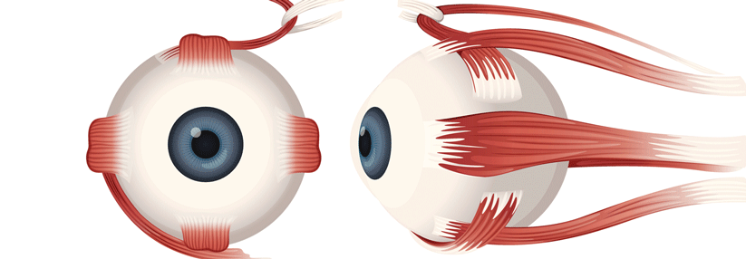 Je nachdem, welche Augenmuskeln durch die Parese ausfallen, weist das Auge eine andere Stellung auf.