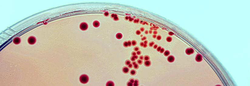 Einer der häufigsten Erreger der SBP ist das Bakterium Escherichia coli.