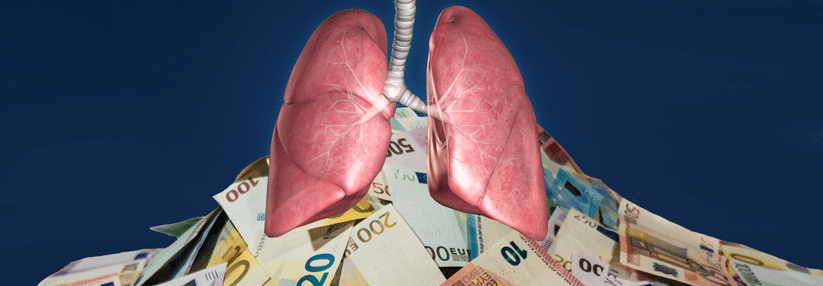 Bronchiektasie-Patienten sind um ein Drittel teurer.