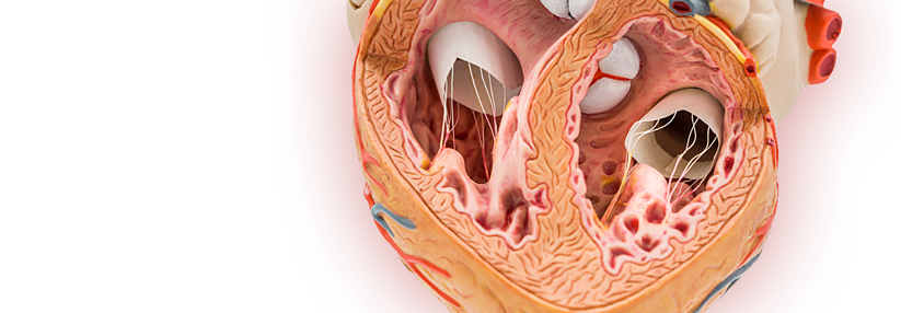 Patienten mit sympto­matischer hypertropher Kardiomyopathie erhalten Betablocker bis zur Maximaldosis.