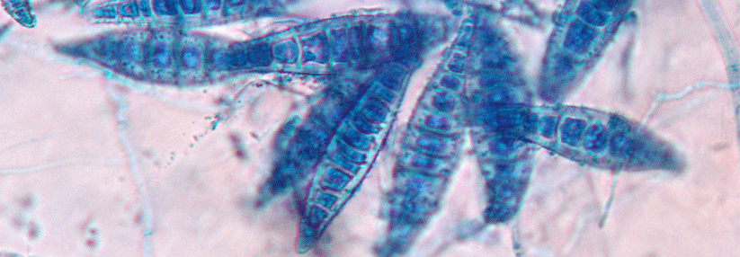 Tinea capitis mit systemischer plus adjuvanter lokaler Therapie behandeln Microsporum canis dominiert unter den Erregern, die eine Tinea capitis verursachen.