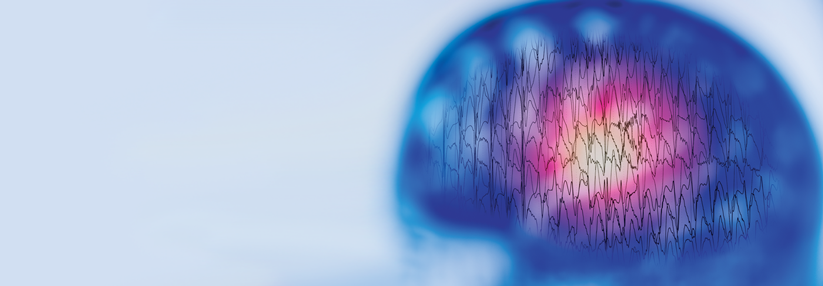 Der Nachweis epilepsietypischer Potenziale im interiktalen EEG unterstützt die Diagnose Epilepsie.
