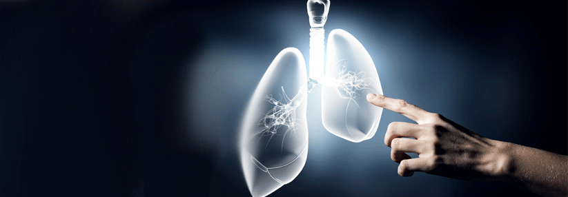 Schweres Asthma besser im Griff Der neu zugelassene Antikörper bremst effektiv die T2-Inflammation.
