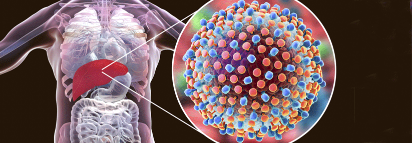 Hepatitis C: Therapie für Patienten mit Zirrhose, Leberkrebs oder Niereninsuffizienz Bis 2030 will die WHO die Prävalenz von Hepatitis C um 90 % senken.