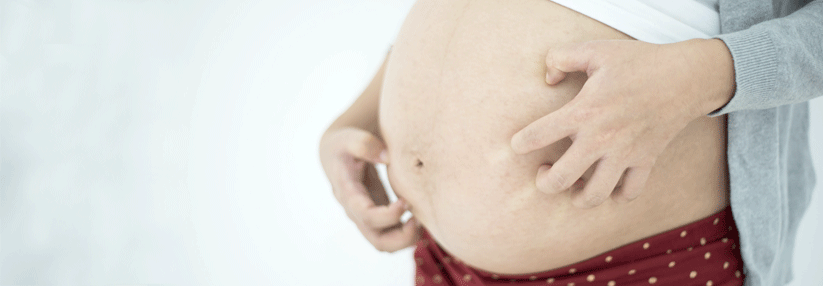 Zwar löst die Cholestase einen unangenehmen Juckreiz bei der Mutter aus, ist jedoch nur bei einem stark erhöhten Gallensäurespiegel auch für das Ungeborene gefährlich.