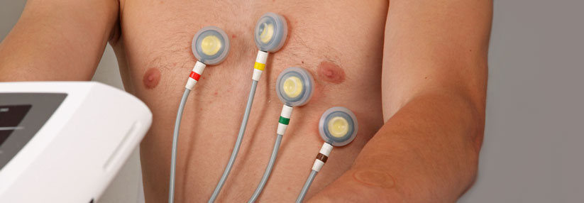 Belastungs-EKG ist in Leitlinien zweitrangig, erleichtert den Alltag aber nach wie vor In Deutschland bleibt das Belastungs-EKG meist weiterhin die erste diagnostische Maßnahme.