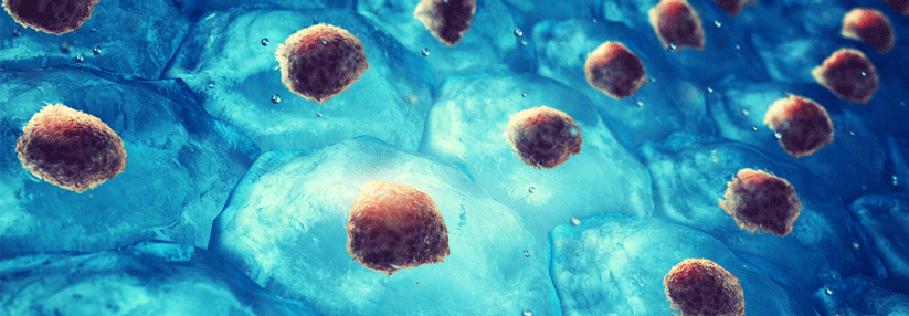 Ist die präventive hämatopoetische
allogene Stammzelltransplantation eine Option?