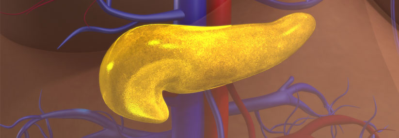 Wenn der Typ-1-Diabetes unkontrollierbar wird, kann die Inselzelltransplantation Abhilfe schaffen.