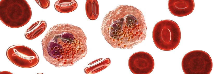 Die Blut-Eosinophilen gelten seit einiger Zeit als das Maß aller Dinge bei entzündlichen Erkrankungen.