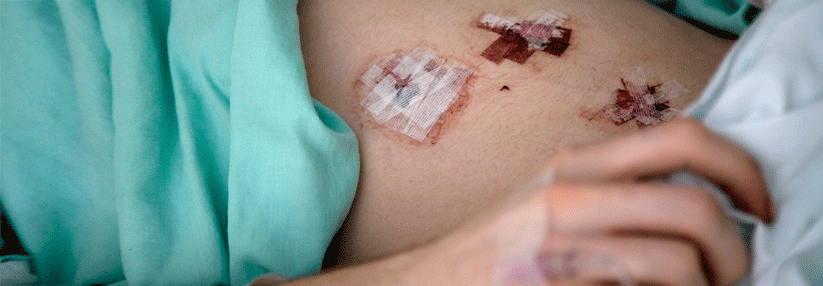 Ein rechtzeitiger Ultraschall hätte die Appendixperforation und somit auch die Operationen wohl verhindern können. (Agenturfoto)