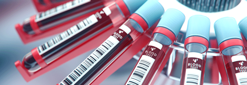 Die Fall-Kontroll-Studie zeigt vielversprechende Daten zum Bluttest. 