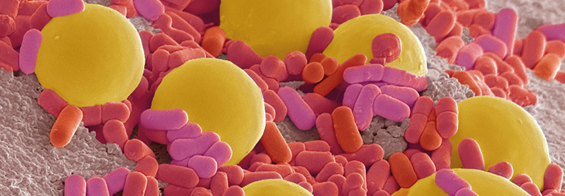 Saccharomyces boulardii (gelb) und diverse Lactobacillus-Arten (rot) sind Teil einer gesunden Darmflora. Sie von außen zuzuführen, wird nur in wenigen Fällen empfohlen.