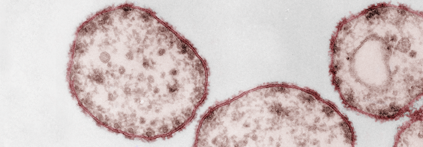 Das Masernvirus gehört zur Familie der Paramyxoviridae.