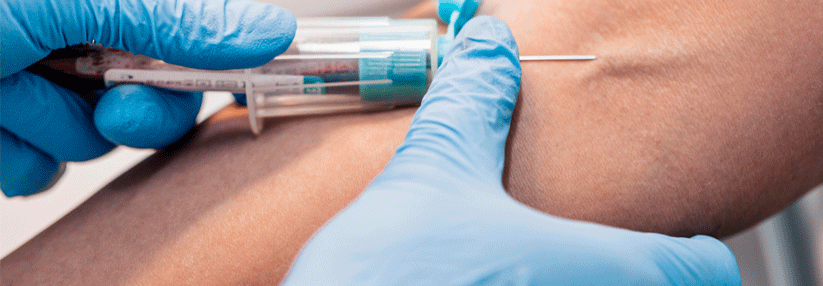 Ein Bluttest könnte in Zukunft KHK-Patienten Aufschluss über ihren Krankheitsverlauf geben.