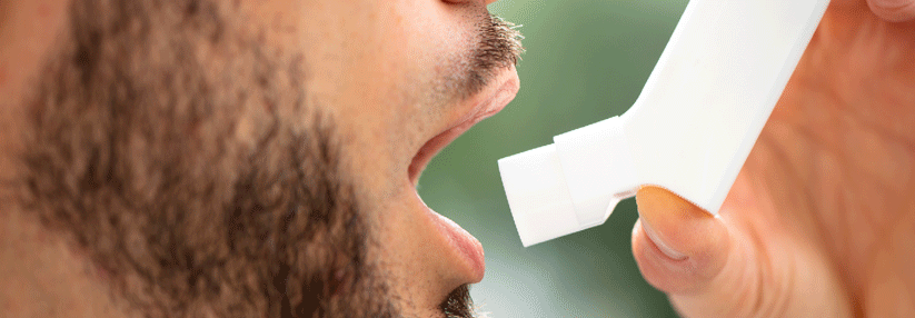 Berufsasthma: Adäquate Therapie ohne systemische Steroide Es ist möglich, mit Berufsasthma weiterzuarbeiten.