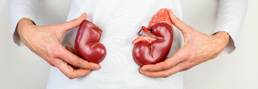 Mit Inhibitoren-Kombi an die Niere Ein Ansprechen fand sich unabhängig von der PD-L1-Expression des Tumors.