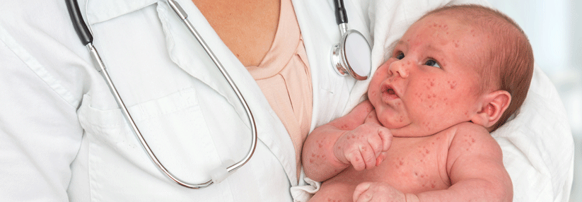 Säuglinge vor dem neunten Lebensmonat zu impfen – das ist Notfällen vorbehalten.