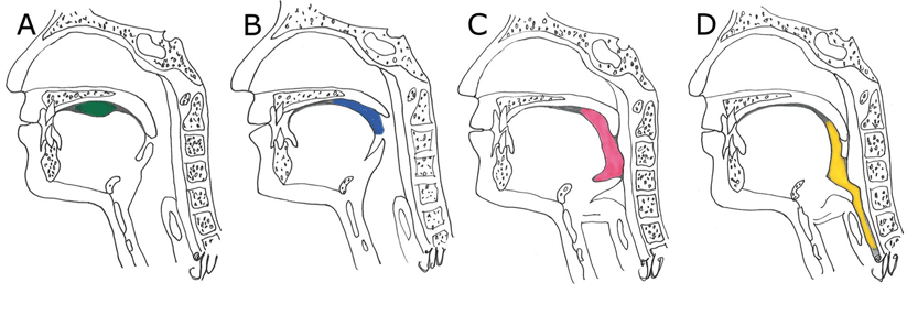 Die vier Phasen des Schlucken: orale Vorbereitungs- (A) und Transportphase (B), pharyngeale (C) und ösophageale (D) Phase.