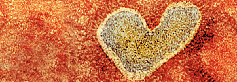 Manche Viruspartikel sehen im Elektronenmikroskop
sogar schon aus wie Herzen, wie diese Aufnahme des Vogelgrippe-Erregers zeigt.