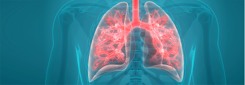 Nitrogenhaltige Bisphosphonate tun auch der Lunge gut.
