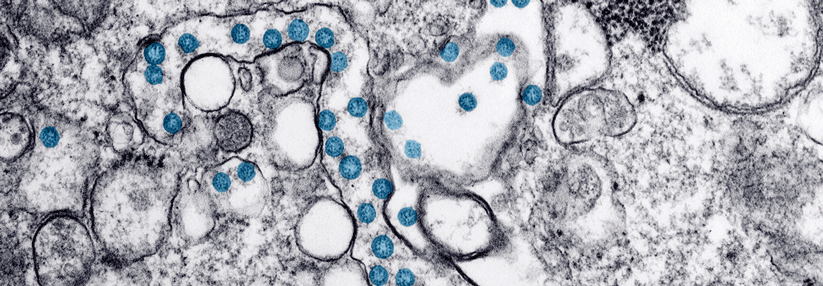 SARS-CoV-2 (blau) unter dem Elektronenmikroskop. Das Isolat stammt vom ersten COVID-19-Fall in den USA.