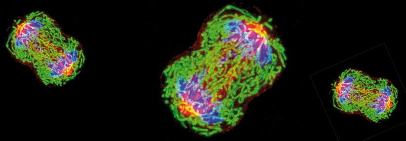 Diese Zelle eines triplenegativen Brustkrebs befindet sich in der Metaphase und wird sich bald teilen. Die Chromosomen sind blau gefärbt.